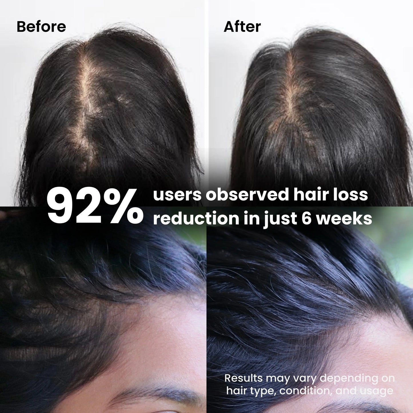 Hair fall reduction after using hair elixir