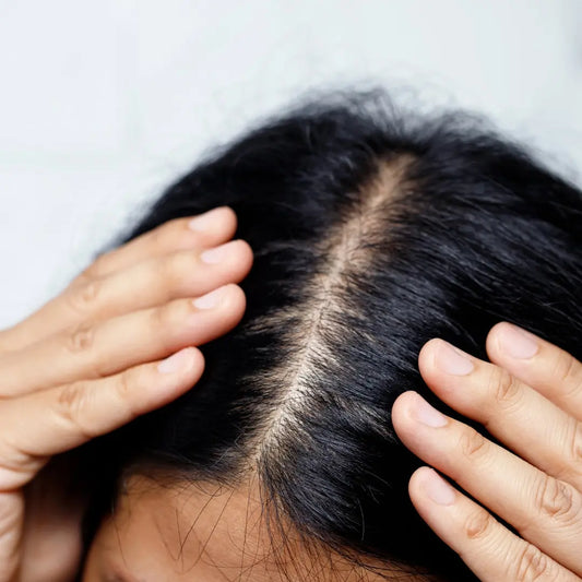 woman facing hair loss issue