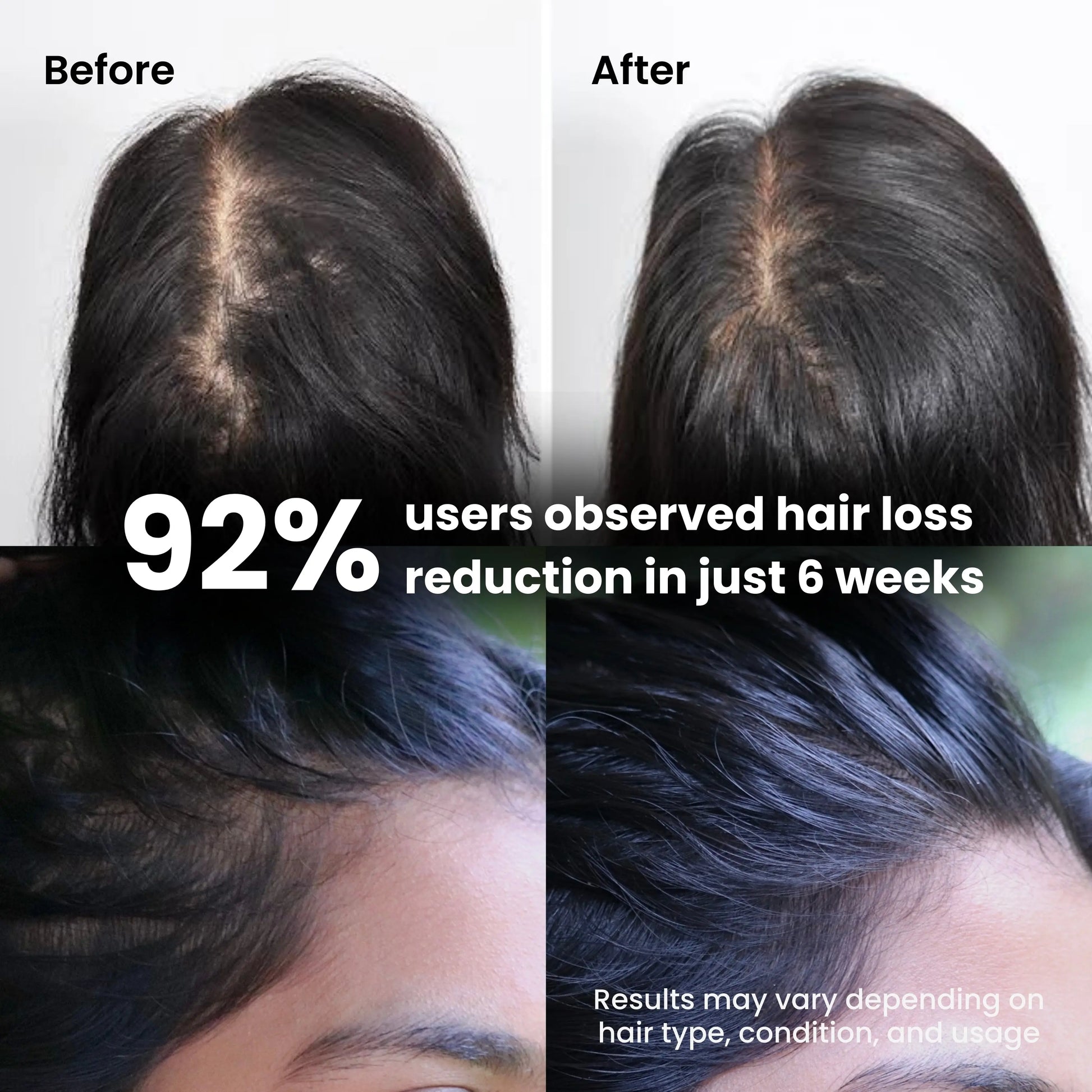Hair fall reduction after using hair elixir